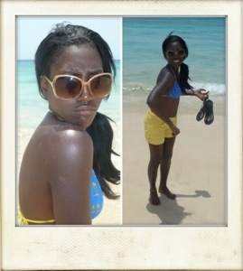 Proof that dark skin burns! Lesson learnt! Sal island, CV